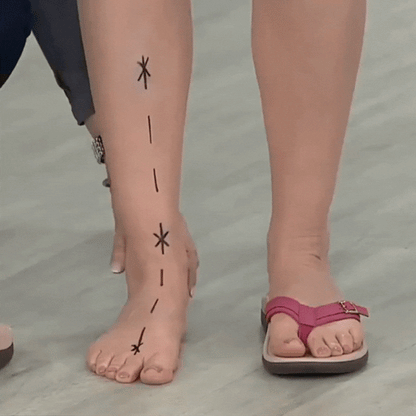 Aubrey™ - Orthopedic Summer Sandals